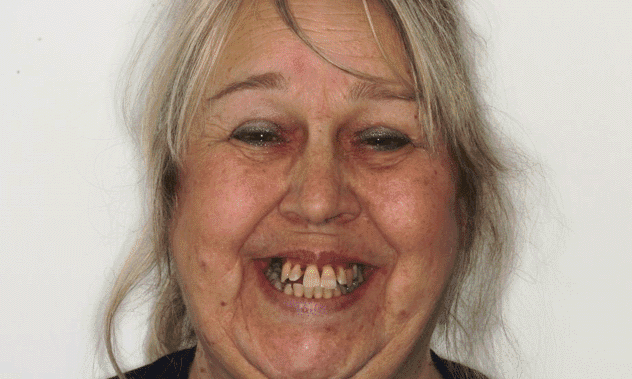 Before treatment, full face